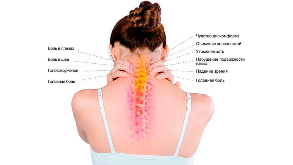 Лечим шею в домашних условиях.